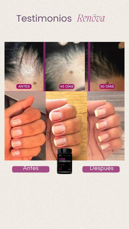 COLAGENO RENÖVA+🧬DOSIS DIARIA DE JUVENTUD!!!